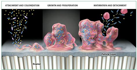 Dental Plaque Formation Stages