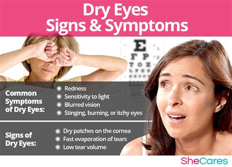 Dry Eyes Syndrome | SheCares