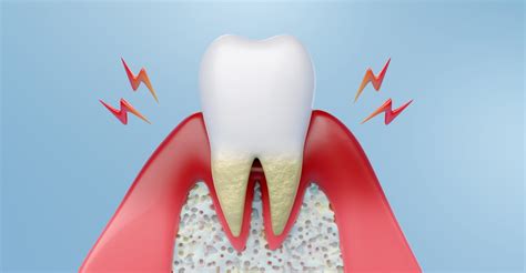 Loose Tooth: Causes, Prevention, and Treatment