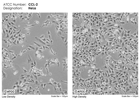 HeLa - CCL-2 | ATCC