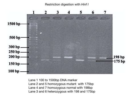 Part 2: Analysing and Interpreting (Agarose) Gel Electrophoresis ...