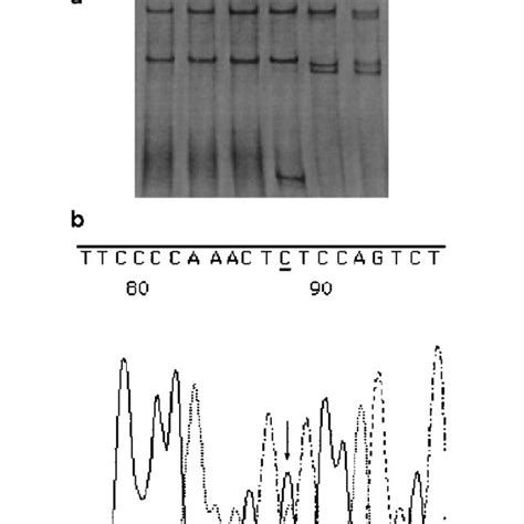 Seven new mutations and three DNA variants in the CFTR gene (IVS... | Download Table