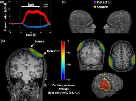 Simultaneous functional near-infrared spectroscopy and electroencephalography for monitoring of ...