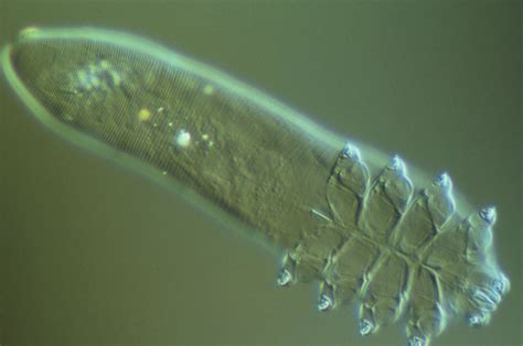 What Are Face Mites Demodex Folliculorum Know Its Causes And Treatment ...