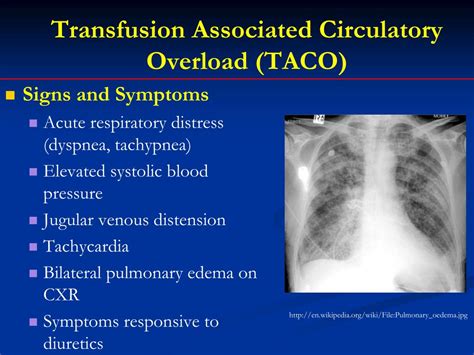 PPT - New Approaches to Preventing Transfusion Reactions PowerPoint ...