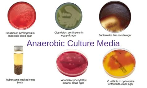 Anaerobic Culture Media • Microbe Online