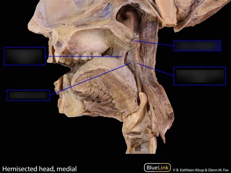 Oral cavity - Muscles Diagram | Quizlet