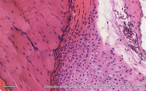 Tendon Histology Labeled