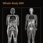 Full Body MRI in less than 10 minutes — Oakland MRI