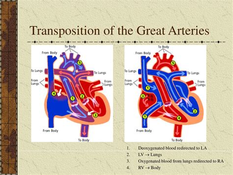 PPT - Transposition of The Great Arteries PowerPoint Presentation - ID ...