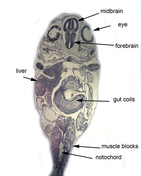 Sections Showing the Development of the Tadpole