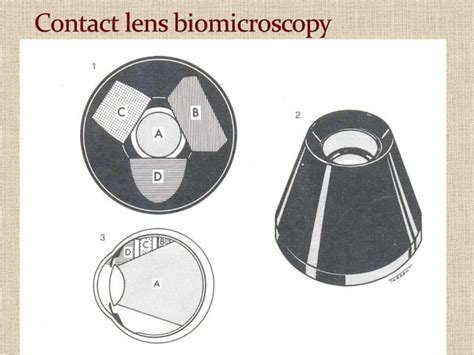 Fundus examination | PPT