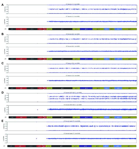 SNP-array analysis on placenta and fetal tissues of Case 1. (A)... | Download Scientific Diagram