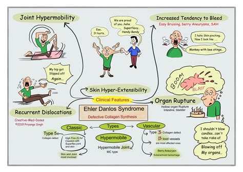 Ehlers-Danlos Syndrome (EDS) - Creative Med Doses