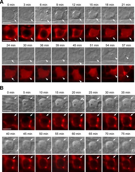 vps-18 is important for phagosome-lysosome fusion. (A) Time-lapse... | Download Scientific Diagram