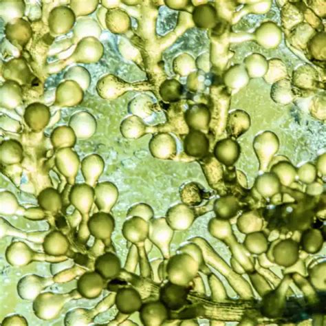 TetraSOD: Microalga Tetraselmis chuii - Equisalud