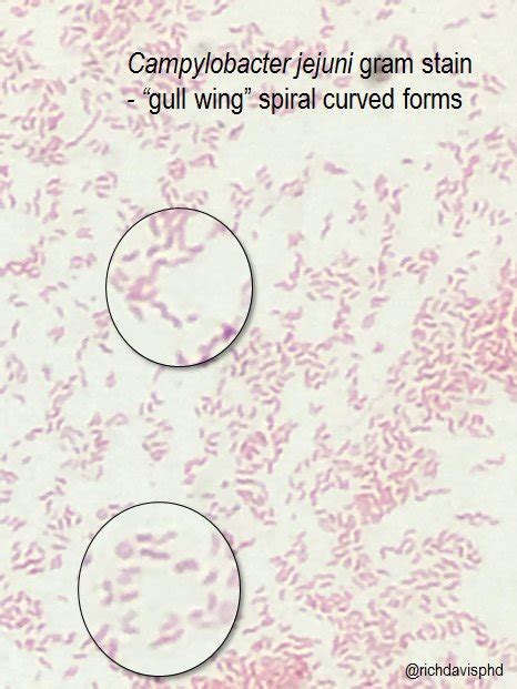 Campylobacter Gram Stain Sales USA | www.micoope.com.gt