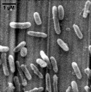 Thiobacillus denitrificans - microbewiki