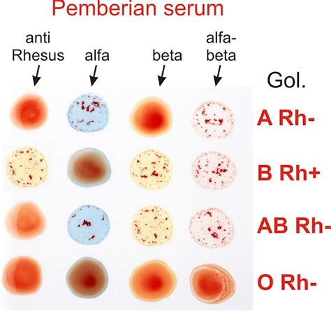 Uji Golongan Darah | BIOLOGIPEDIA