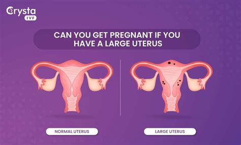 Bulky Uterus Meaning: Can You Get Pregnant If You Have A Large Uterus?