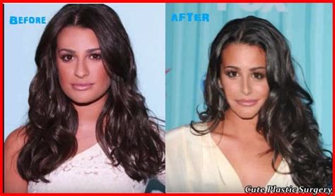 Did Lea Michele Get a Nose Job? - Celebrities Plastic Surgery