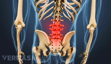 4 Reasons You May Have a Stiff Back | Spine-health