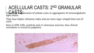 Urine casts | PPT