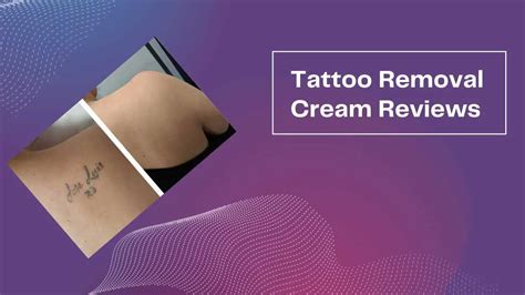 6 Best Tattoo Removal Creams That Works Fast to Remove Tattoos - Tattoo ...