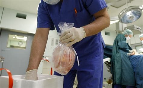 Organ transplant list in the US favours the rich over those most in need