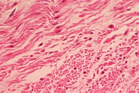 Basic Histology -- Smooth Muscle, Longitudinal and Cross Sections