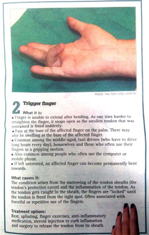 Trigger Finger Treatment in Singapore | Orthopaedic Clinic Singapore