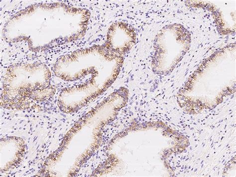 CD47 Antibody (PA5-80435)