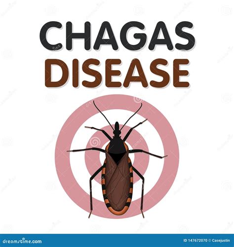 Chagas Disease, Kissing Bug Bite Stock Vector - Illustration of bloodsucker, feeding: 147672070