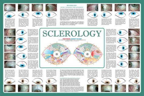 SCLEROLOGY WALLCHART – Grand Medicine Eyology | Iridology