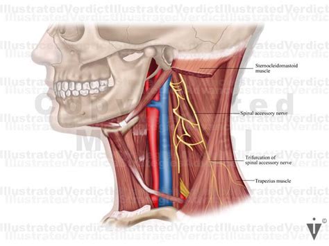 Stock Neck: Spinal Accessory Nerve — Illustrated Verdict