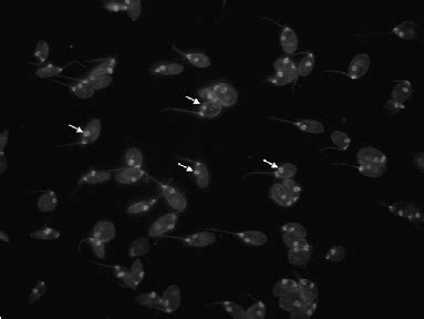 Anti-dsDNA antibodies are directed against the kinetoplast ( arrows ...