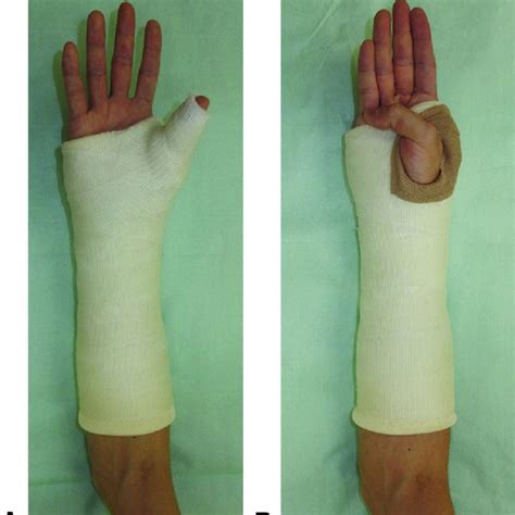 The representative wrist motion during forearm rotation from supination... | Download Scientific ...