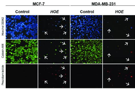 Fluorescence imaging for determination of cell death mode in MCF-7 and... | Download Scientific ...