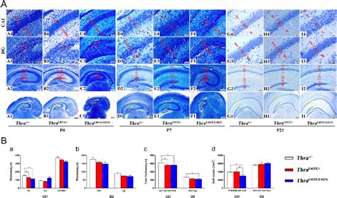 Representative photomicrographs of Nissl-stained coronal sections of ...