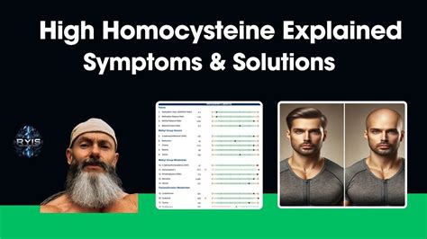 High Homocysteine Explained: Hair loss, Symptoms and Solutions - YouTube