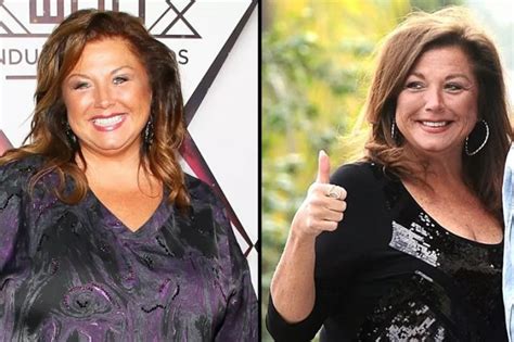 Checkout The Celebrities Who Have Had Gastric Sleeve Surgery Or Other ...