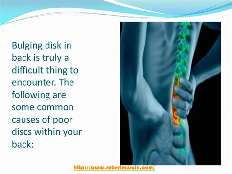 PPT - Causes, Symptoms, and Treatment of a Bulging Disc Lower Back PowerPoint Presentation - ID ...