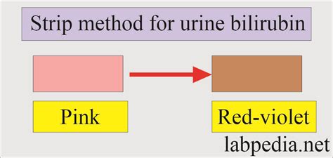 Urine Bilirubin, Bilirubinuria - Labpedia.net