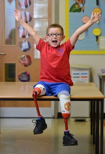Artificial Knee Limb For Children at best price in Noida by Bornlife Prosthetic & Orthotic Inc ...