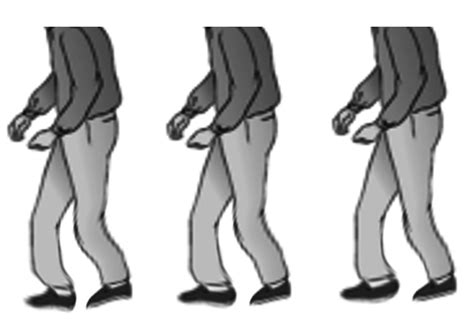 [Figure, Shuffling gait in parkinson disease Image courtesy S Bhimji MD ...