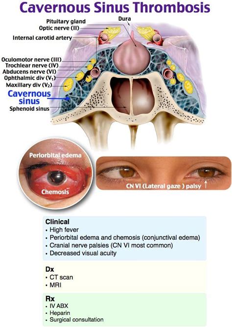 Related image | Medical knowledge, Human anatomy and physiology, Medical