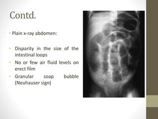 Meconium disease | PPT