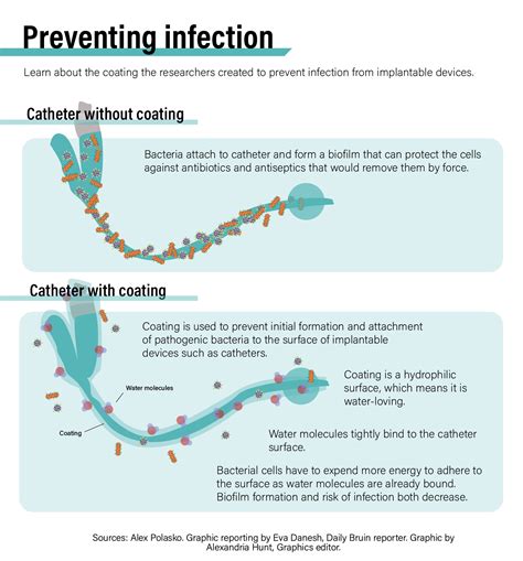 UCLA professor’s company creates new antibacterial coating for medical ...