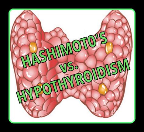 Hypothyroidism and Hashimoto's Disease - Holistic Treatment by Dr. Tsan