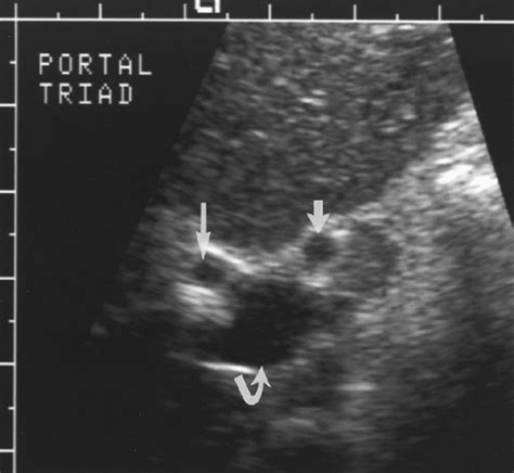 Abdomen Ultrasound | Radiology Key